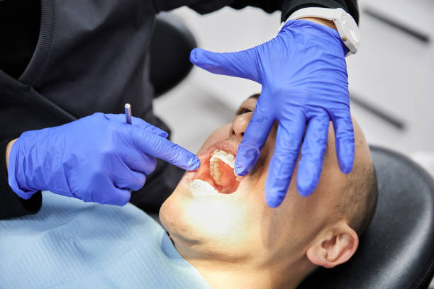 Best Root Canal Emergency Dentist  in Ossun, LA
