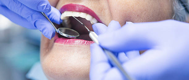 Tooth Infection Emergency Dentist in LA